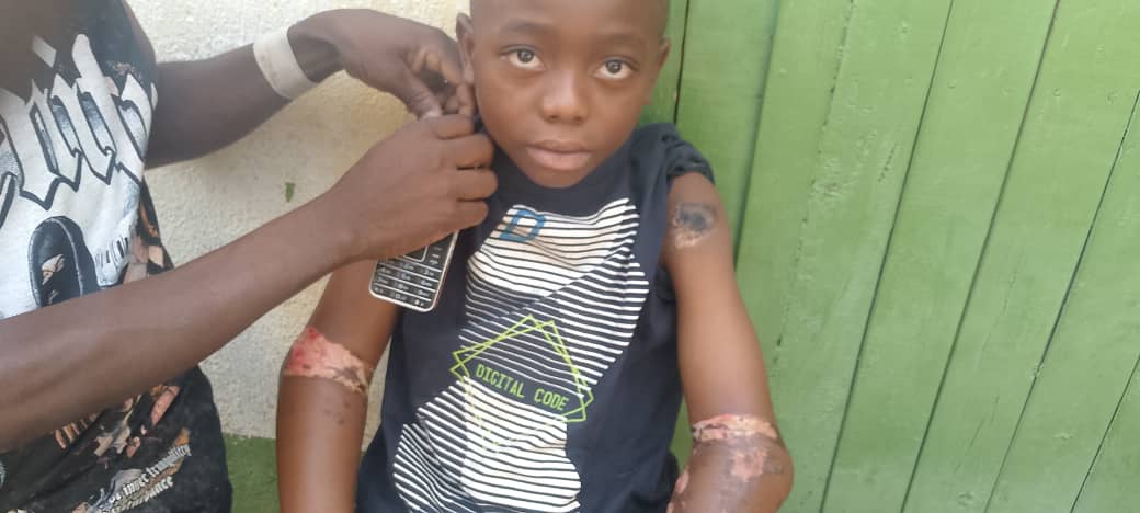 Baraka : un enfant de 10 ans hospitalisé après des actes de torture présumés, la société civile exige justice