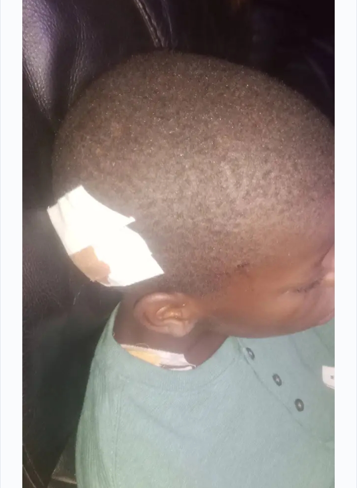 Uvira : un enfant tué et un autre grièvement blessé par l’explosion d’une grenade