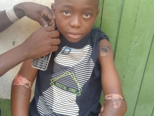 Baraka : un enfant de 10 ans hospitalisé après des actes de torture présumés, la société civile exige justice