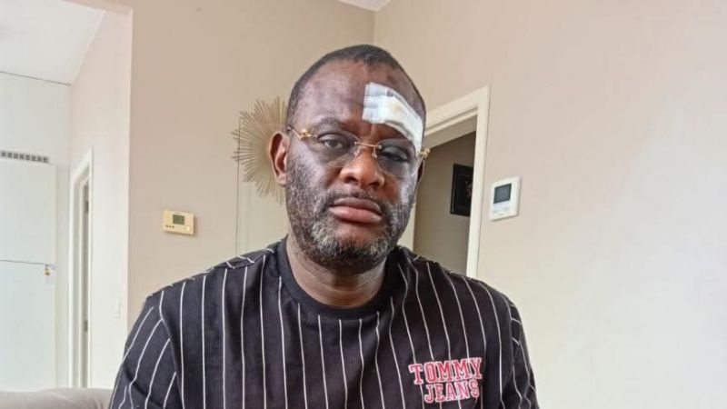 Belgique : le journaliste Claude Pero Luwara de nouveau agressé à Tirlemont
