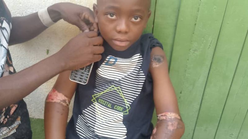 Baraka : un enfant de 10 ans hospitalisé après des actes de torture présumés, la société civile exige justice