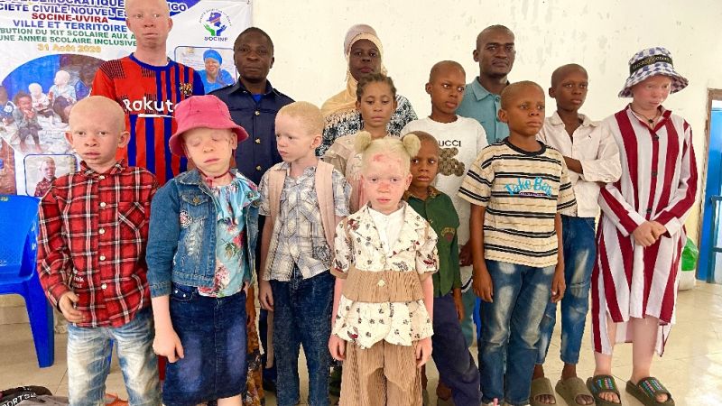 Uvira : la SOCINE offre des kits scolaires à plusieurs enfants albinos à la veille de la rentrée