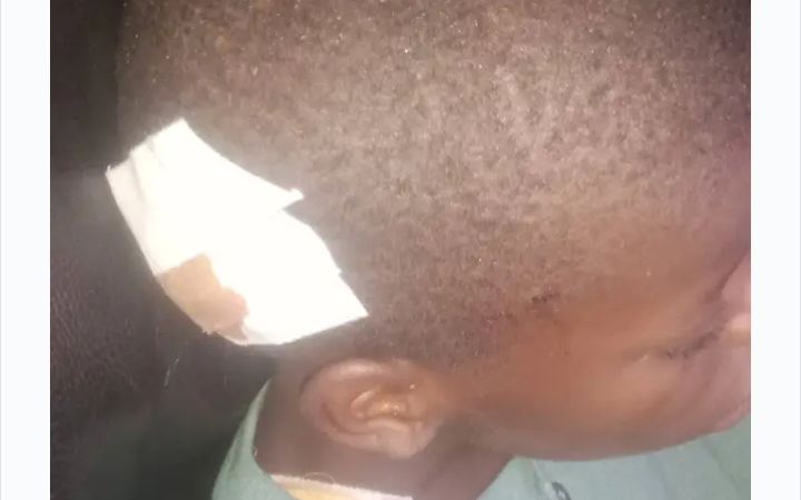 Uvira : un enfant tué et un autre grièvement blessé par l’explosion d’une grenade
