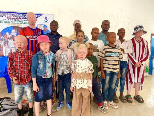 Uvira : la SOCINE offre des kits scolaires à plusieurs enfants albinos à la veille de la rentrée