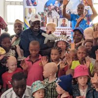 Uvira : la SOCINE plaide pour la scolarisation et la prise en charge des enfants albinos